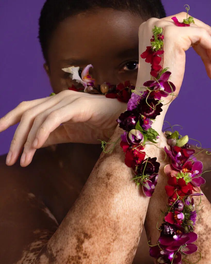 A person with vitiligo holds their wrists crossed in front of their face against a purple background. Their arms are adorned with vibrant red, pink, and purple editorial flowers intertwined with green vines, showcasing exquisite floral styling. Their gaze is focused through the space between their arms.